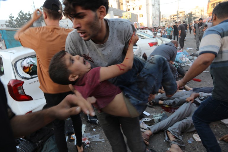 An injured Palestinian boy is carried from the ground following an Israeli airstrike outside the entrance of the al-Shifa hospital in Gaza City.